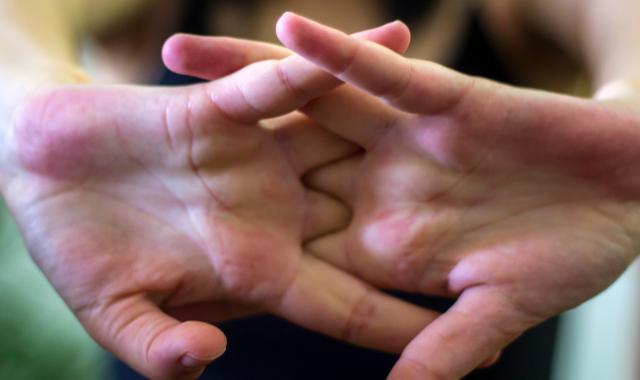 cracking knuckles, hand arthritis