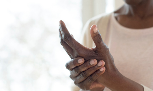 rheumatoid arthritis flare