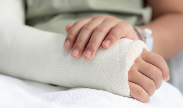 broken bone cast